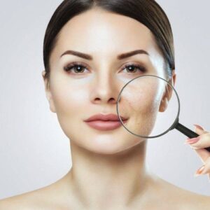 Biostimolazione
