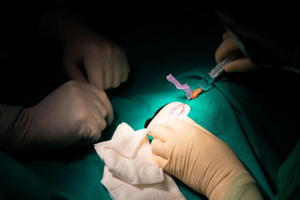 Intervento di chirurgia dermatologica
