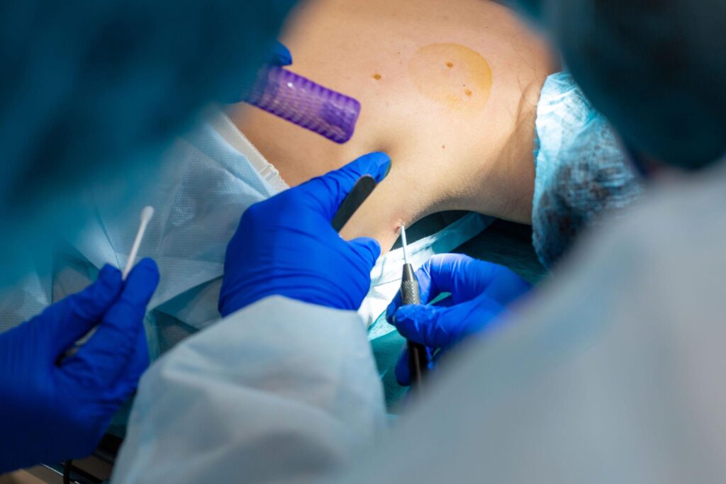 Anestesia locale in chirurgia dermatologica