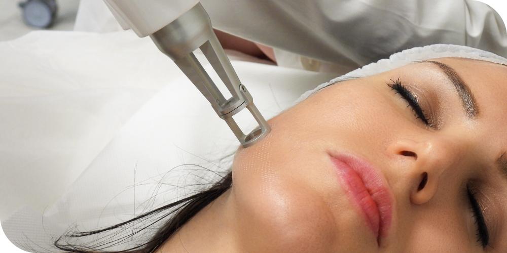 manipolo laser erbio