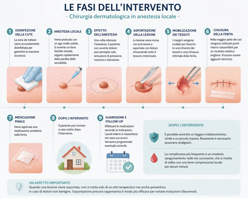 Schema delle fasi dell'intervento